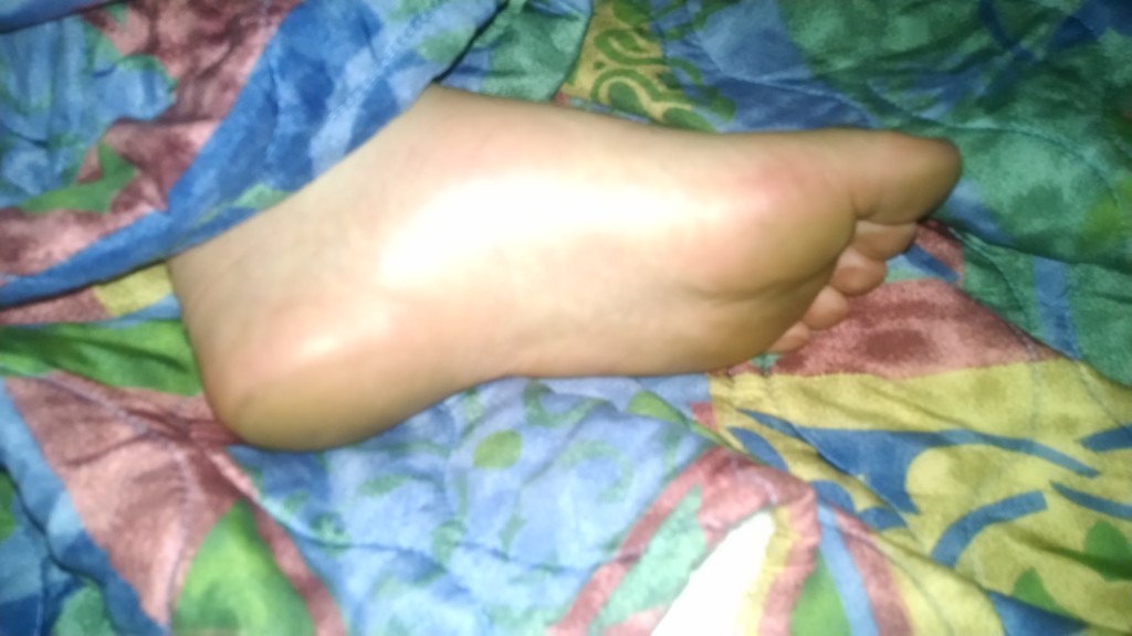 Kevin's Aching Arch